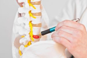 hernia-discal-lumbar
