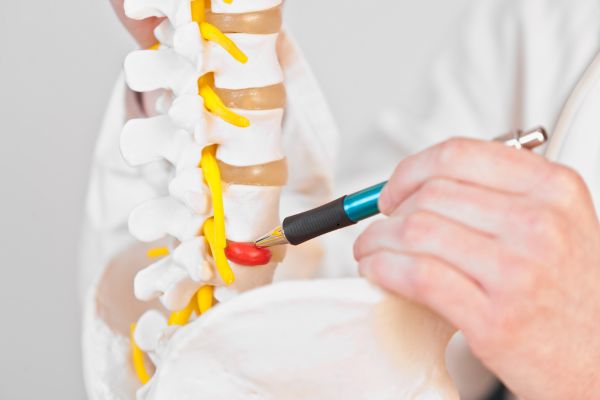 hernia-discal-lumbar