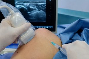 hidrodilatacion articular